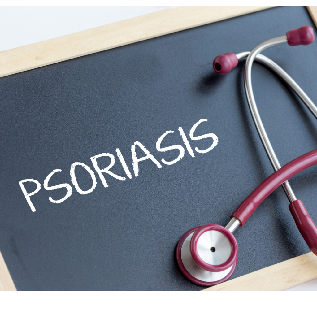 psoriasis written in chalk on chalkboard with stethoscope on the side.